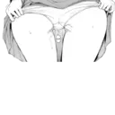 Adhesiu